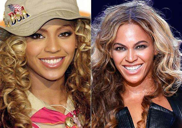 Burun Estetiği Yaptıran Ünlüler Beyonce