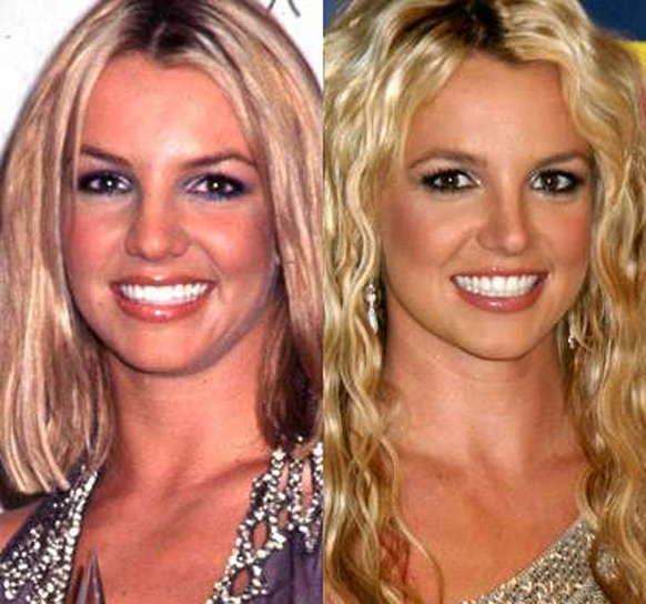 Burun Estetiği Yaptıran Ünlüler Britney Spears
