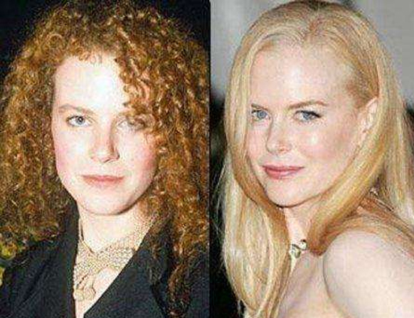 Burun Estetiği Yaptıran Ünlüler Nicole Kidman